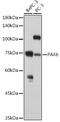 P21 (RAC1) Activated Kinase 6 antibody, GTX33383, GeneTex, Western Blot image 