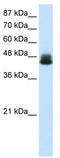 Zinc Finger Protein 785 antibody, TA341482, Origene, Western Blot image 