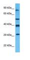 Acidic Nuclear Phosphoprotein 32 Family Member B antibody, orb327229, Biorbyt, Western Blot image 