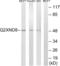 Cytochrome P450 Family 2 Subfamily D Member 6 antibody, LS-C120504, Lifespan Biosciences, Western Blot image 