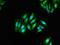 Galactosidase Beta 1 antibody, LS-C678086, Lifespan Biosciences, Immunofluorescence image 