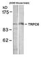 Transient Receptor Potential Cation Channel Subfamily C Member 6 antibody, orb14705, Biorbyt, Western Blot image 