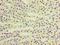 Ras-related protein Rab-6A antibody, LS-C370207, Lifespan Biosciences, Immunohistochemistry paraffin image 