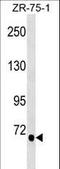 Transglutaminase 5 antibody, LS-C157183, Lifespan Biosciences, Western Blot image 