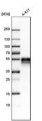 Tumor Associated Calcium Signal Transducer 2 antibody, HPA043104, Atlas Antibodies, Western Blot image 