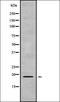 Endonuclease Domain Containing 1 antibody, orb338293, Biorbyt, Western Blot image 