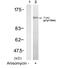 Tyrosine Kinase 2 antibody, PA5-37762, Invitrogen Antibodies, Western Blot image 