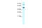 Erythrocyte Membrane Protein Band 4.2 antibody, 27-947, ProSci, Enzyme Linked Immunosorbent Assay image 