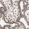 Interleukin 1 Receptor Like 1 antibody, HPA007406, Atlas Antibodies, Immunohistochemistry frozen image 