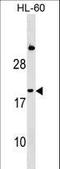 Interferon alpha-1 antibody, LS-C159882, Lifespan Biosciences, Western Blot image 