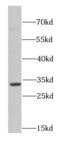 SET Nuclear Proto-Oncogene antibody, FNab07764, FineTest, Western Blot image 