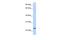 ChaC Glutathione Specific Gamma-Glutamylcyclotransferase 1 antibody, PA5-42212, Invitrogen Antibodies, Western Blot image 