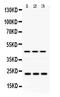 RAB13, Member RAS Oncogene Family antibody, PA5-79902, Invitrogen Antibodies, Western Blot image 