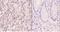X-Ray Repair Cross Complementing 5 antibody, A01275S462, Boster Biological Technology, Immunohistochemistry paraffin image 