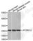 Apolipoprotein B MRNA Editing Enzyme Catalytic Subunit 2 antibody, A3375, ABclonal Technology, Western Blot image 