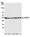 GAPDH antibody, A300-639A, Bethyl Labs, Western Blot image 