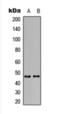 Arginine Vasopressin Receptor 1B antibody, orb393220, Biorbyt, Western Blot image 