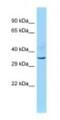 INO80 Complex Subunit B antibody, NBP1-98506, Novus Biologicals, Western Blot image 