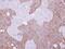 Keratin 15 antibody, PA5-27218, Invitrogen Antibodies, Immunohistochemistry paraffin image 