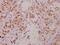 Component Of Inhibitor Of Nuclear Factor Kappa B Kinase Complex antibody, PA5-36652, Invitrogen Antibodies, Immunohistochemistry frozen image 