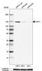Cadherin 1 antibody, AMAb90865, Atlas Antibodies, Western Blot image 