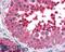 Adhesion G Protein-Coupled Receptor A3 antibody, 46-851, ProSci, Western Blot image 