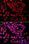 SET Domain Containing 6, Protein Lysine Methyltransferase antibody, LS-C346300, Lifespan Biosciences, Immunofluorescence image 