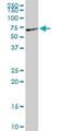 VRK Serine/Threonine Kinase 2 antibody, H00007444-D01P, Novus Biologicals, Western Blot image 