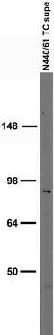 Chromaffin granule amine transporter antibody, 75-431, Antibodies Incorporated, Western Blot image 