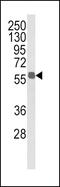 Aldehyde Dehydrogenase 3 Family Member B1 antibody, MBS9214855, MyBioSource, Western Blot image 