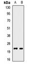 CD99 Molecule (Xg Blood Group) antibody, LS-C668042, Lifespan Biosciences, Western Blot image 