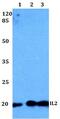 Interleukin 2 antibody, GTX66758, GeneTex, Western Blot image 