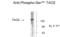 TAO Kinase 2 antibody, XPS-1029, ProSci, Western Blot image 