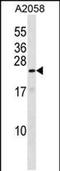 KRAB Box Domain Containing 4 antibody, PA5-48762, Invitrogen Antibodies, Western Blot image 