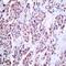 Nuclear Factor Kappa B Subunit 2 antibody, 79-266, ProSci, Immunohistochemistry paraffin image 