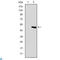 Troponin I2, Fast Skeletal Type antibody, LS-C812792, Lifespan Biosciences, Western Blot image 