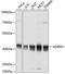 Adhesion Regulating Molecule 1 antibody, GTX65581, GeneTex, Western Blot image 