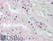 Proprotein Convertase Subtilisin/Kexin Type 6 antibody, 46-729, ProSci, Immunohistochemistry frozen image 