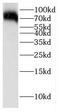 Glutamate-Cysteine Ligase Catalytic Subunit antibody, FNab03386, FineTest, Western Blot image 