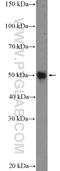 Whirlin antibody, 25881-1-AP, Proteintech Group, Western Blot image 