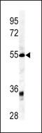 Growth/differentiation factor 6 antibody, LS-C100696, Lifespan Biosciences, Western Blot image 