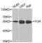 FGR Proto-Oncogene, Src Family Tyrosine Kinase antibody, A2075, ABclonal Technology, Western Blot image 