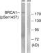 BRCA1 DNA Repair Associated antibody, abx012674, Abbexa, Western Blot image 