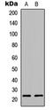 Prostaglandin E Synthase 3 antibody, LS-C358257, Lifespan Biosciences, Western Blot image 