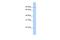 Transmembrane And Coiled-Coil Domain Family 2 antibody, A15276, Boster Biological Technology, Western Blot image 