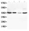 Vascular Endothelial Growth Factor D antibody, PA1332, Boster Biological Technology, Western Blot image 