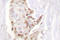 Histone Deacetylase 5 antibody, LS-C176058, Lifespan Biosciences, Immunohistochemistry frozen image 