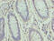 Zinc Finger Protein 555 antibody, CSB-PA026835LA01HU, Cusabio, Immunohistochemistry paraffin image 