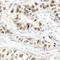 BRCA1 DNA Repair Associated antibody, STJ22044, St John