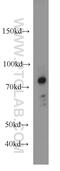 Caldesmon 1 antibody, 20887-1-AP, Proteintech Group, Western Blot image 